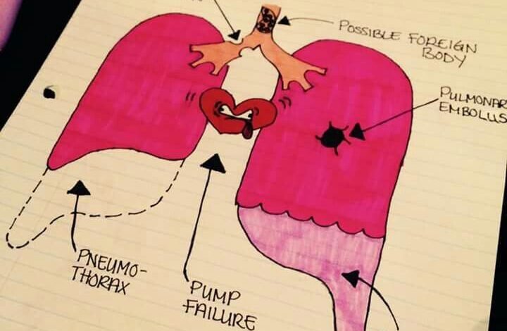 nclex style questions thorax and lungs​