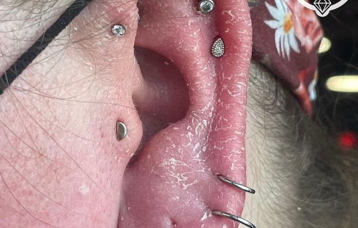 can i get piercing if i have ear eczema​