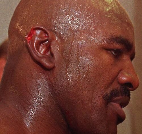 evander holyfield ear​